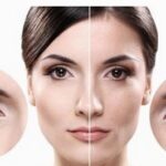 aquajetpeel
